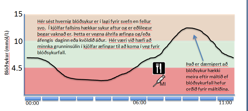 Að koma í veg fyrir blóðsykursföll að næturlagi