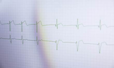Hjartalaeknar-fa-storan-styrk-til-ad-rannsaka-hjartavodvasjukdom