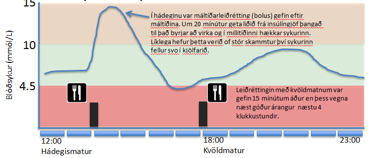 Að gefa réttan skammt með máltíðum (bolus)