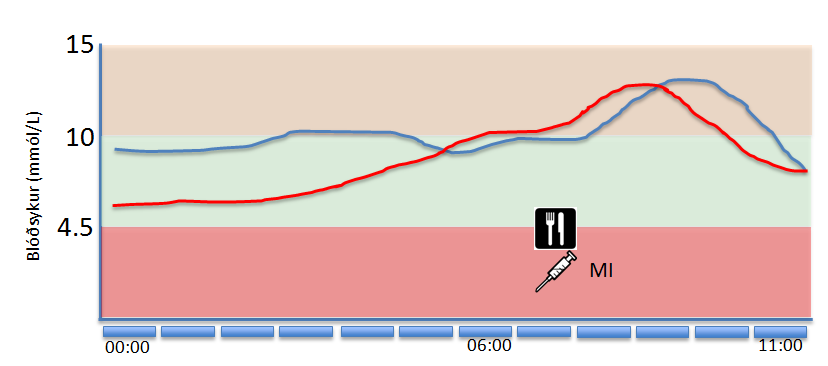 Að ná markmiðum í sykurstjórn á morgnana